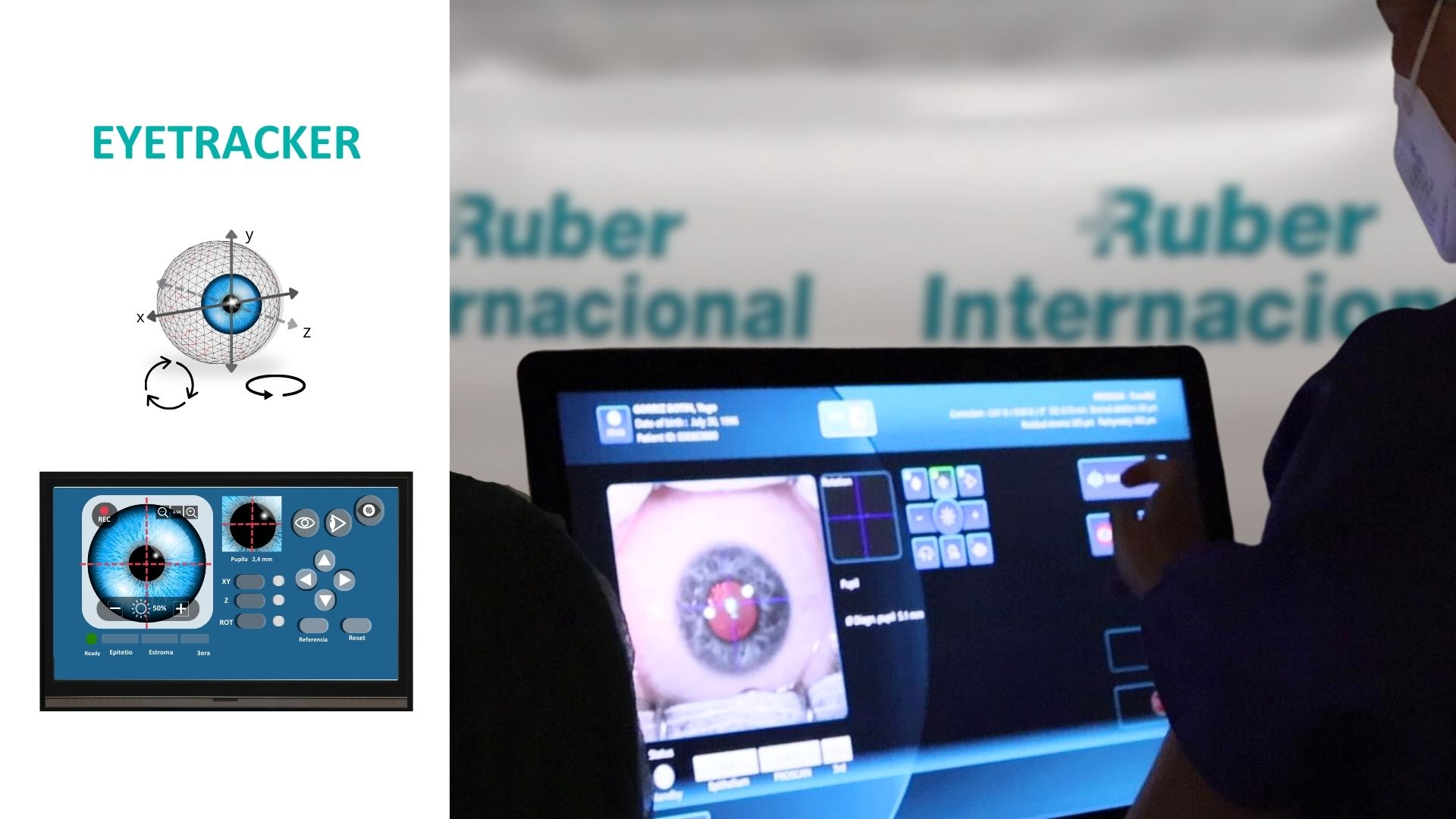 Eyetracker: La tecnología de seguimiento ocular que hace más segura y precisa la cirugía refractiva láser