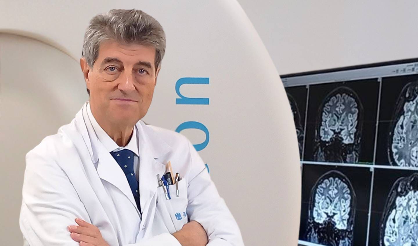 Cirugía cerebral gamma knife dr Roberto Martínez