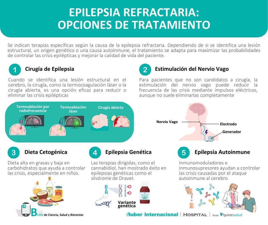 tratamiento de la epilepsia refractaria