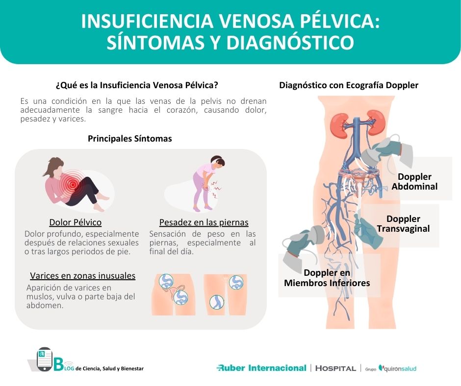 insuficiencia venosa pelvica sintomas diagnostico