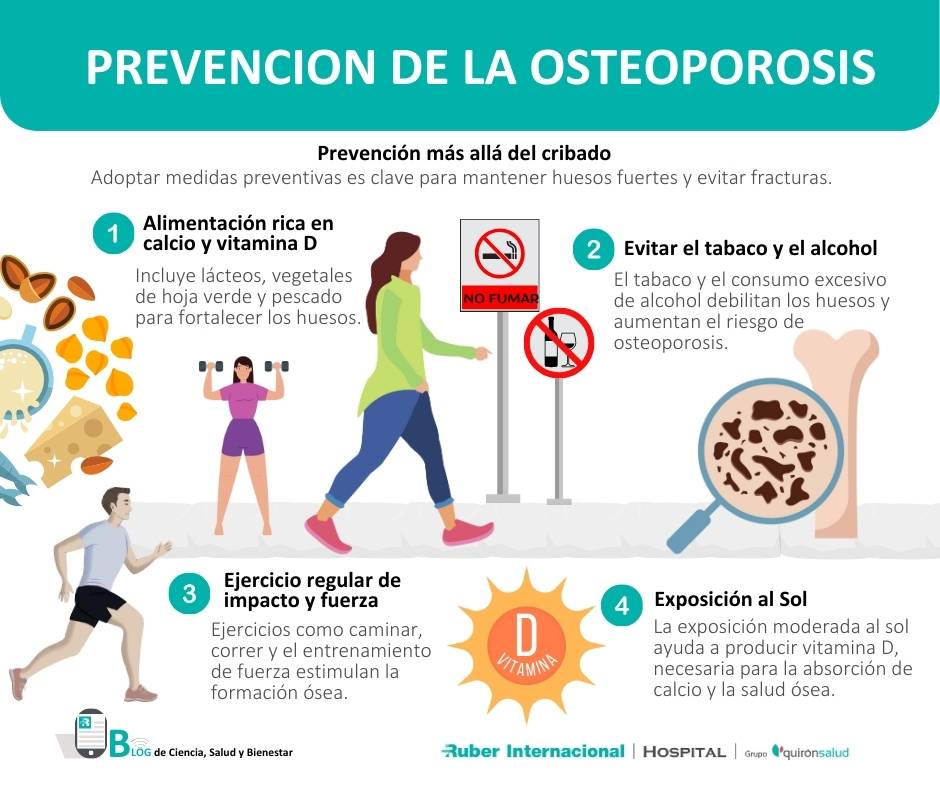 Prevencion de osteoporosis y fracturas