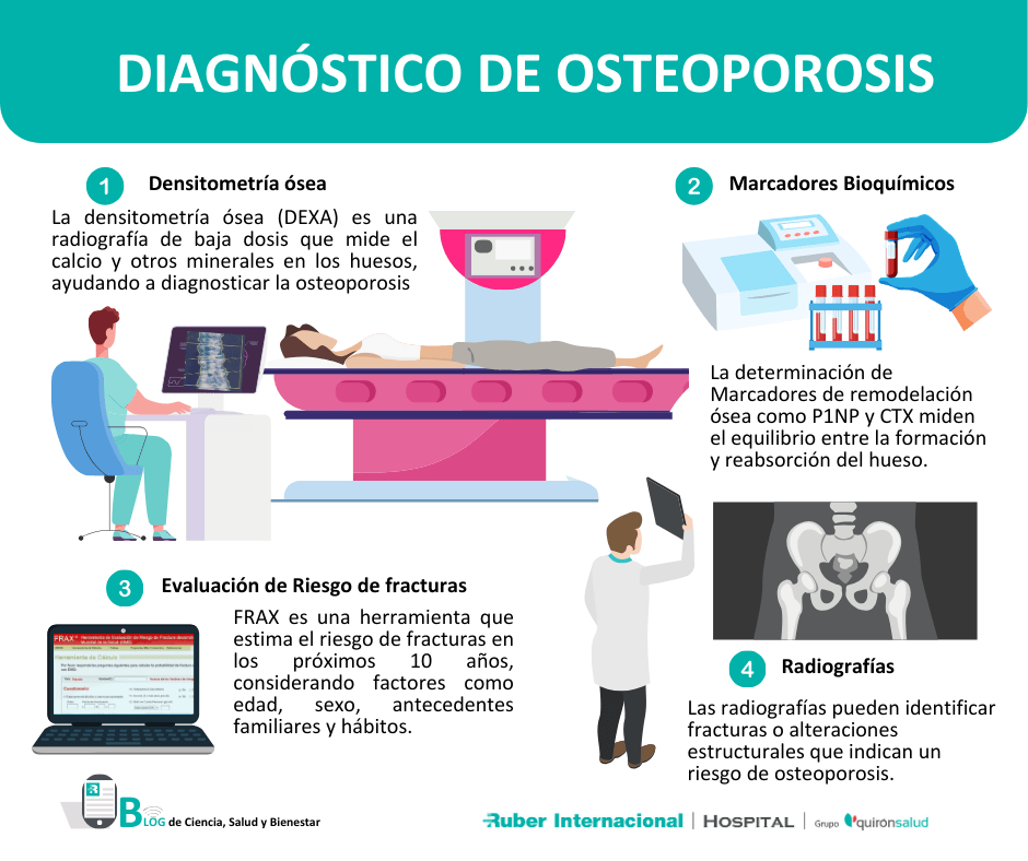 Diagnostico de osteoporosis. Este enlace se abrirá en una ventana nueva