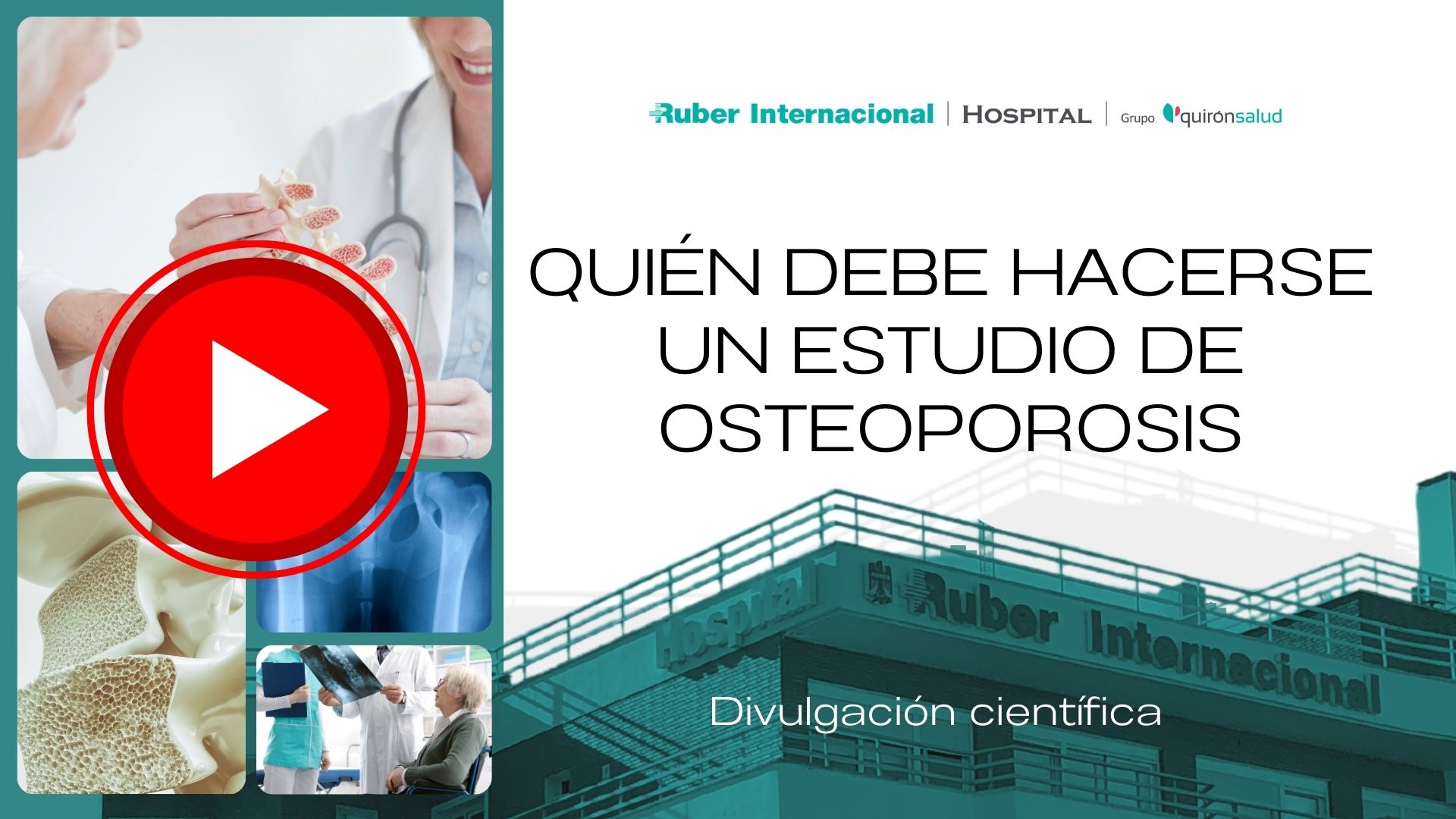 quien debe hacerse evaluacion osteoporosis. Este enlace se abrirá en una ventana nueva