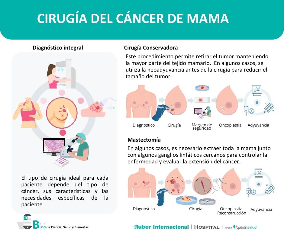 Cirugia cancer de mama recuperacion