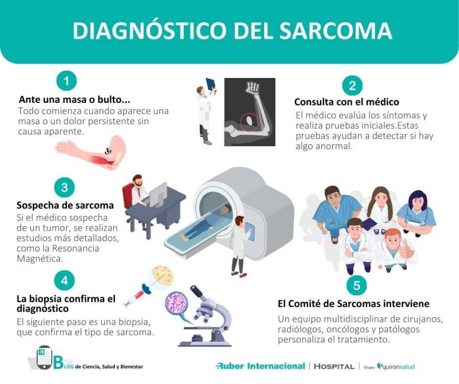 Diagnostico y tratamiento del sarcoma