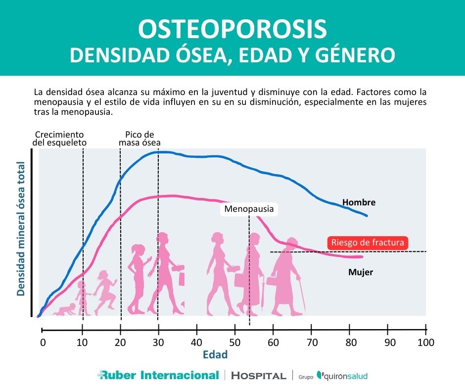 osteoporosis densidad osea