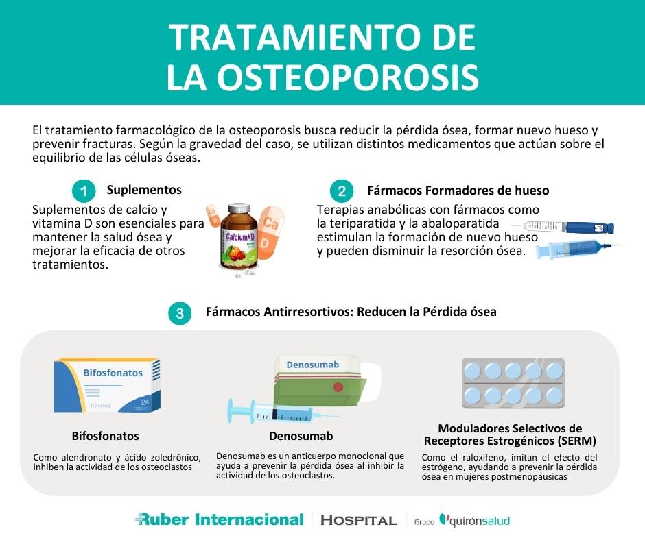 Tratamiento de la osteoporosis