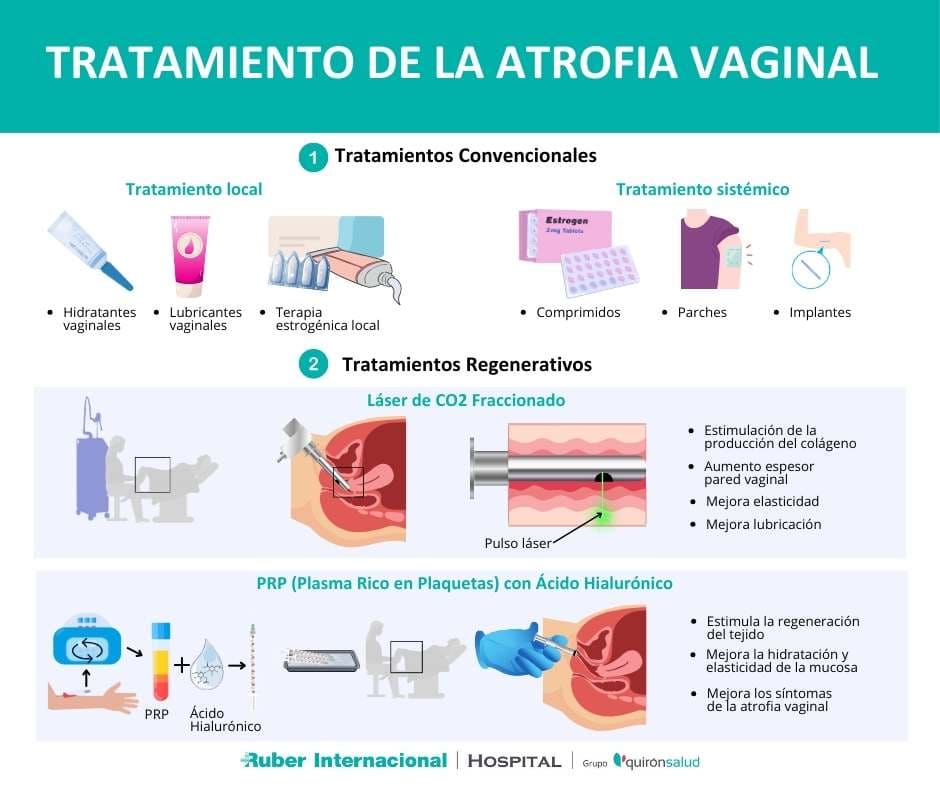 Tratamiento de la atrofia vaginal laser fraccionado