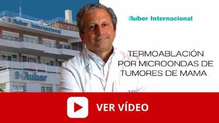 video tratamiento tumor mama termoablacion microondas. Este enlace se abrirá en una ventana nueva