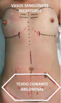 esquema operacion