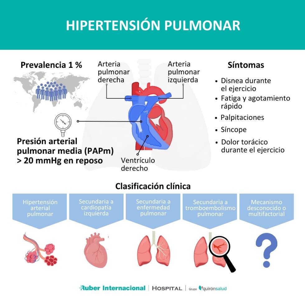 Hipertensión Pulmonar Síntomas y tratamiento