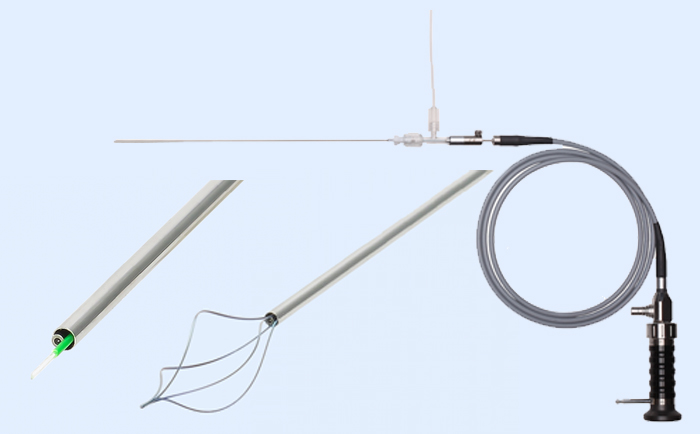 Material de Micro-ureterorrenoscopia utilizado para extraer cálculos renales