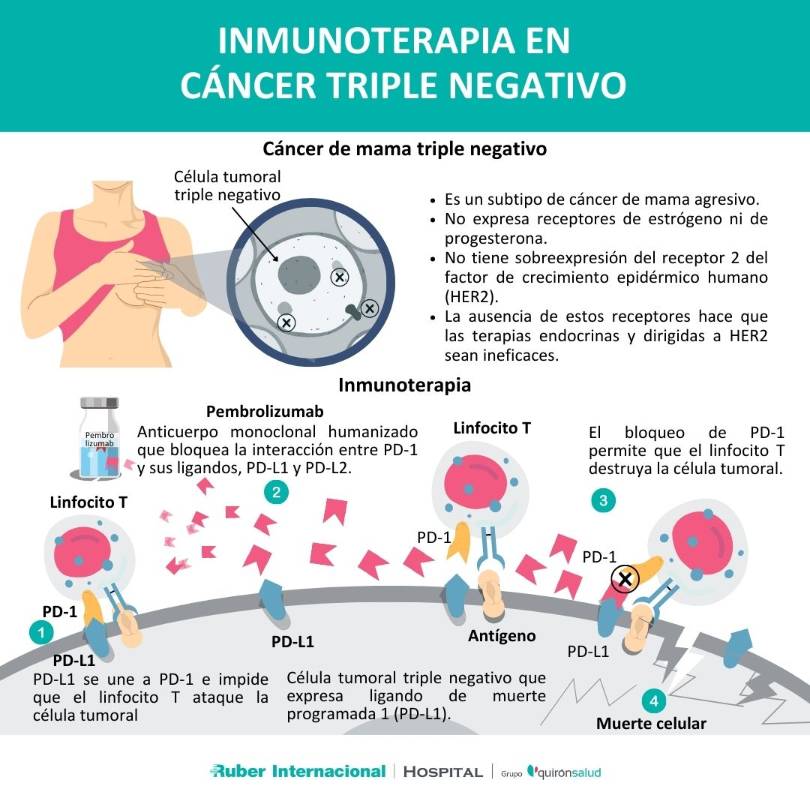 cancer de mama triple negativo tratamiento