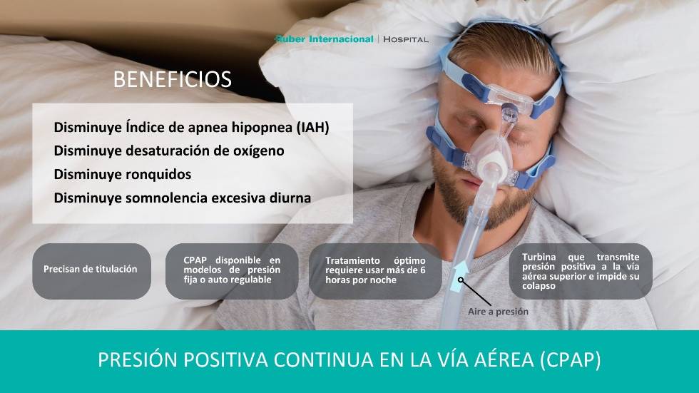 Tratamiento de la apnea del sueño con CPAP Presión continua de aire en la vía respiratoria