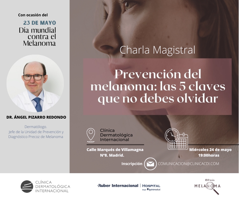 Prevención del Melanoma: las cinco claves que no debes olvidar