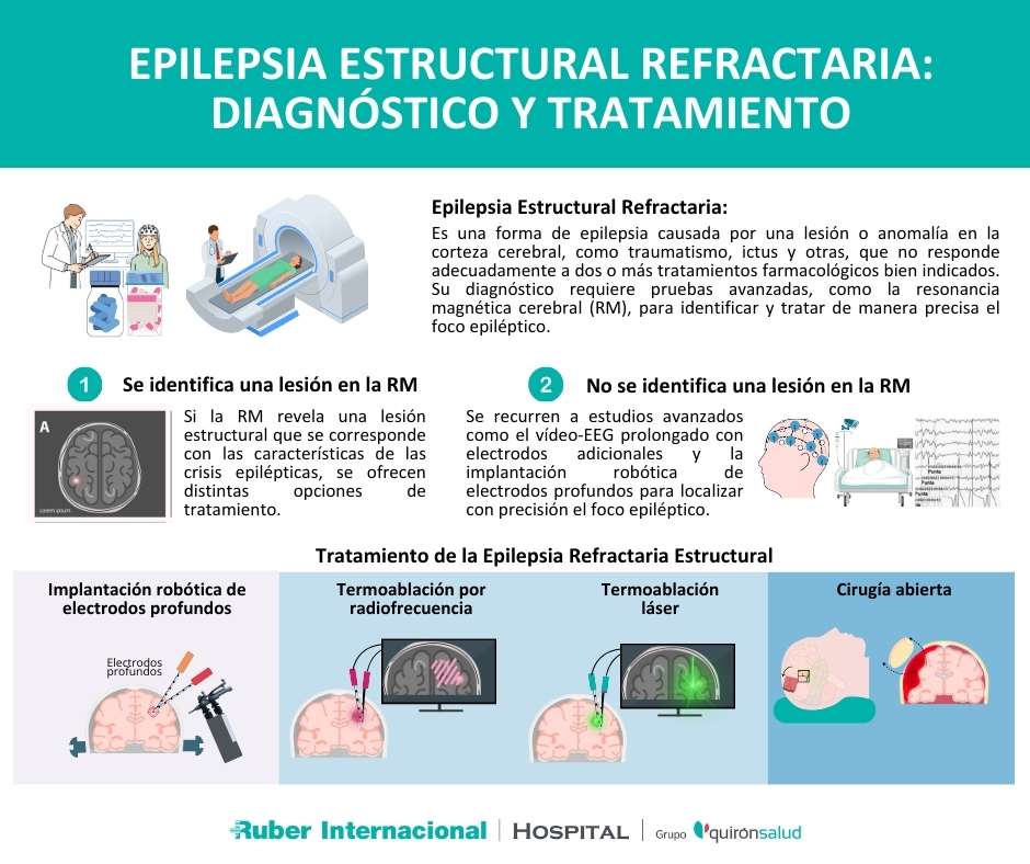 epilepsia refractaria diagnostico tratamiento