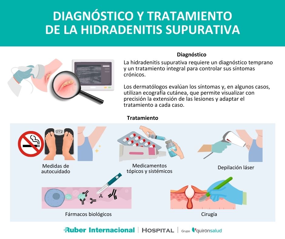 Diagnostico y tratamiento Hidradenitis Supurativa