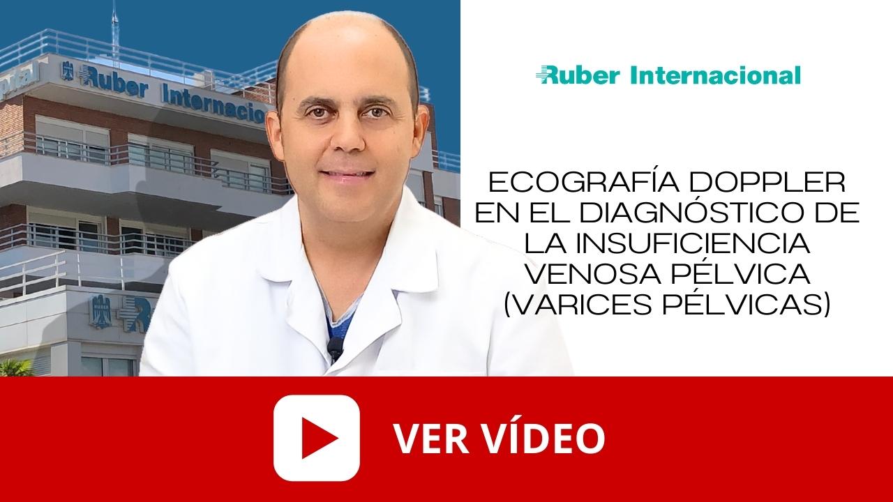 ecografia doppler diagnostico varices pelvicas. Este enlace se abrirá en una ventana nueva