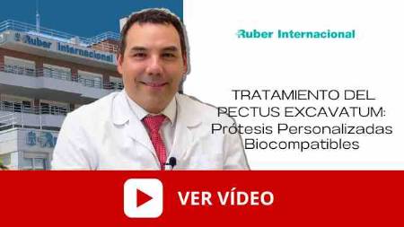 video tratamiento pectus excavatum protesis. Este enlace se abrirá en una ventana nueva