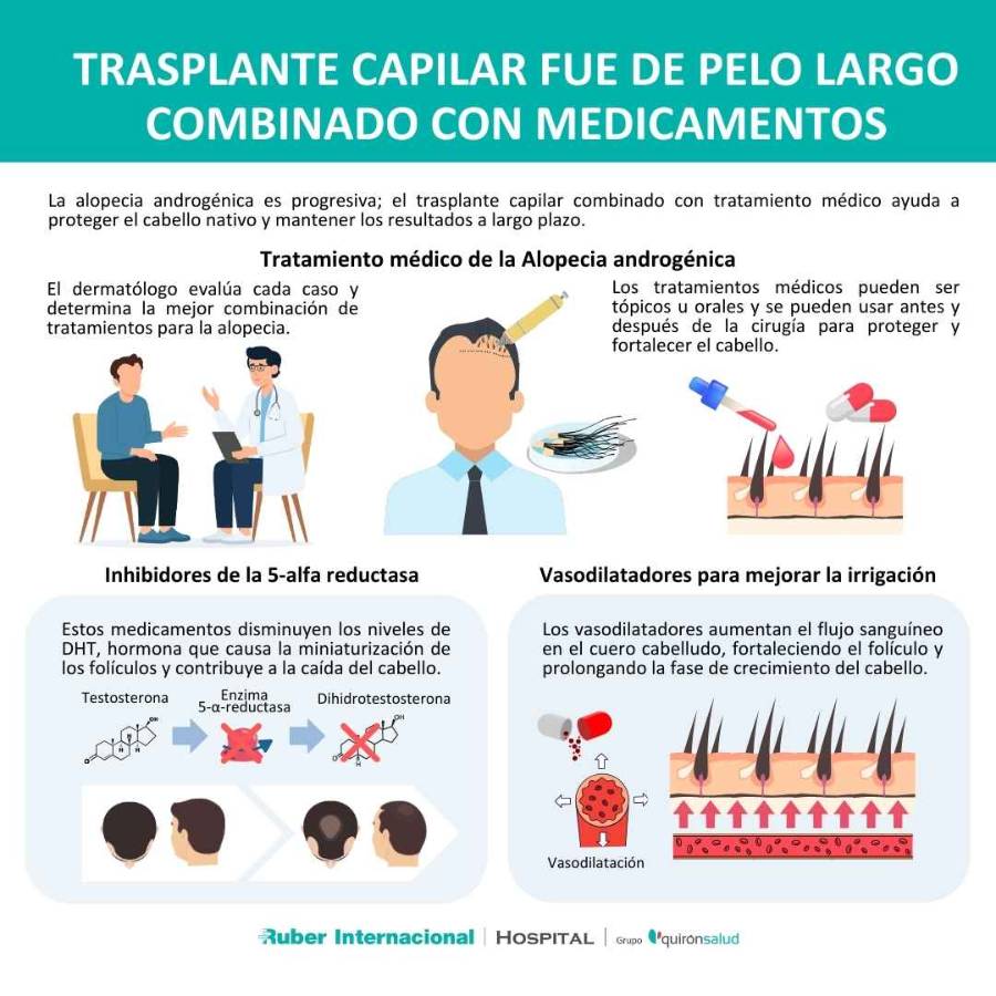 trasplante capilar fue pelo largo y medicamentos alopecia