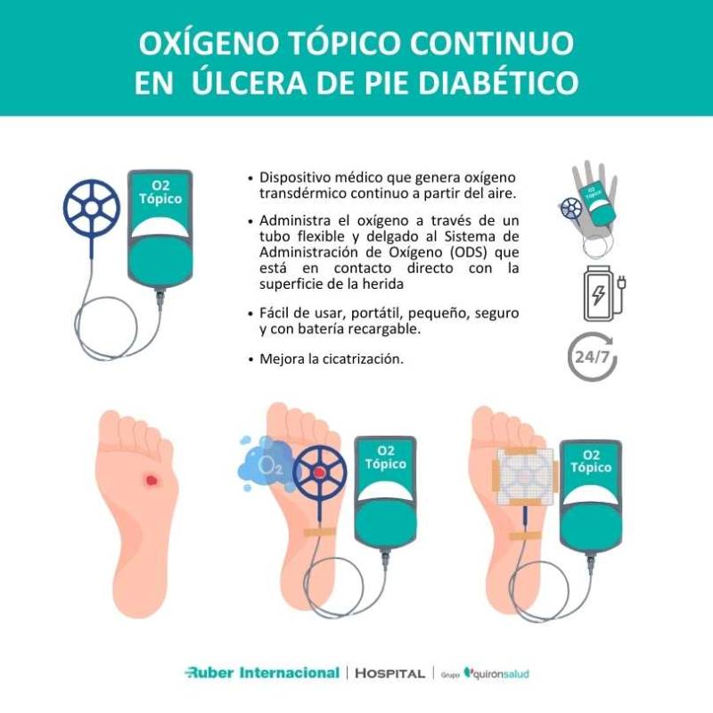 oxígeno tópico en tratamiento de úlcera de pie diabético