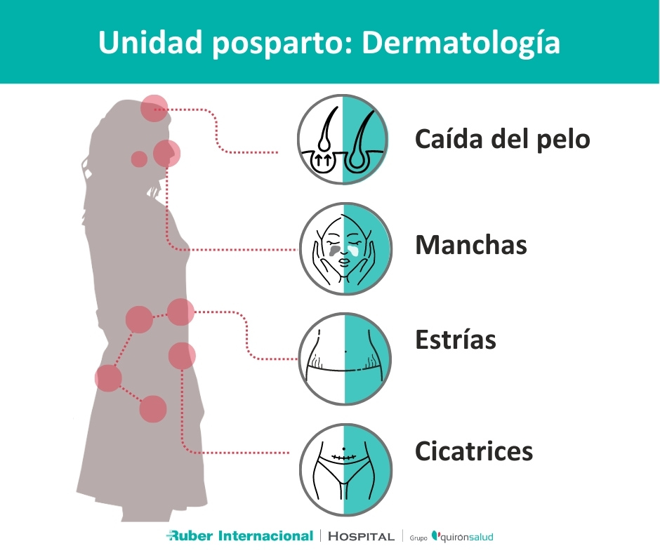 Unidad posparto tratamiento de la piel en el embarazo, parto y posparto