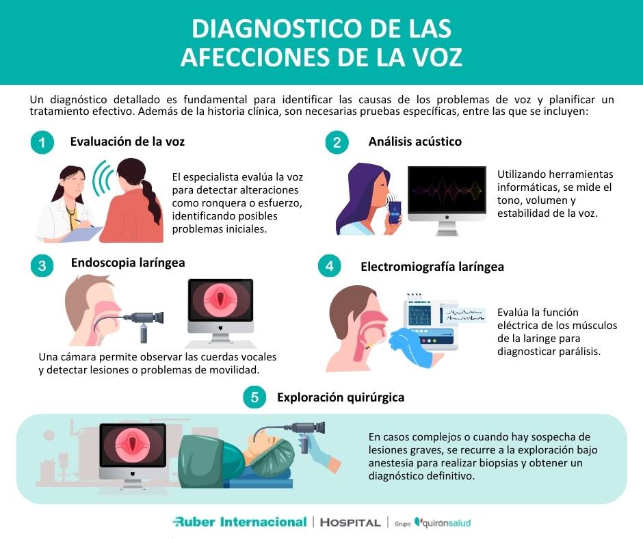 diagnostico cirugia cuerdas vocales