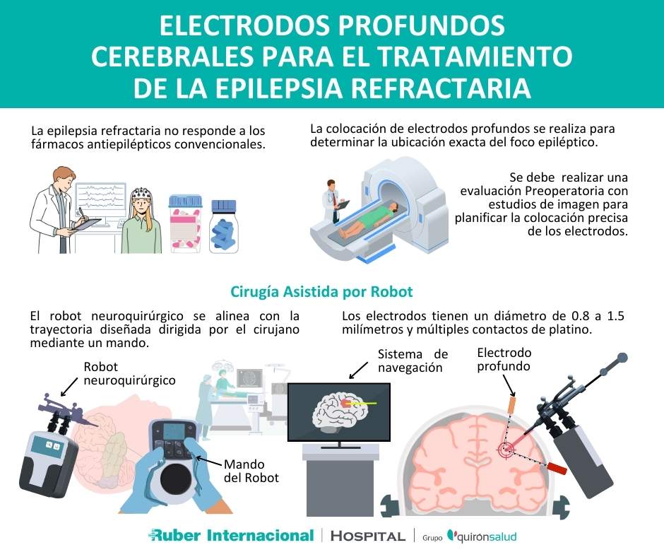 epilepsia refractaria diagnostico tratamiento electrodos profundos