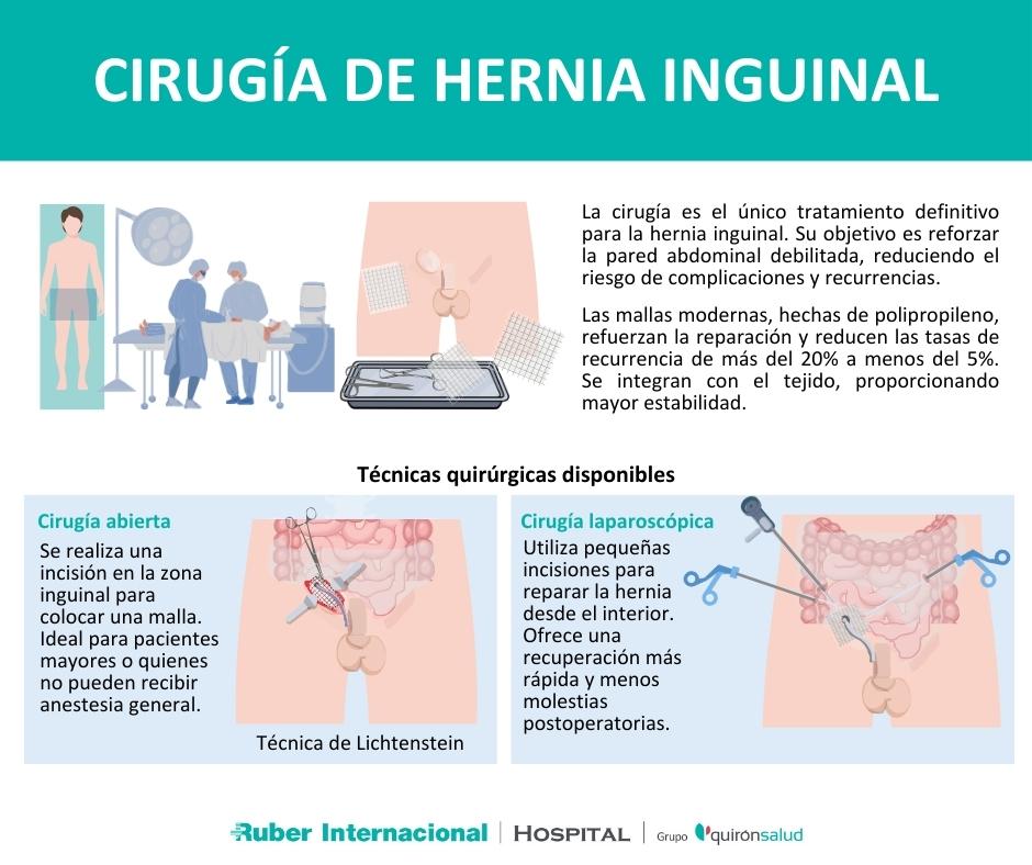 Cirugía de la hernia inguinal técnicas