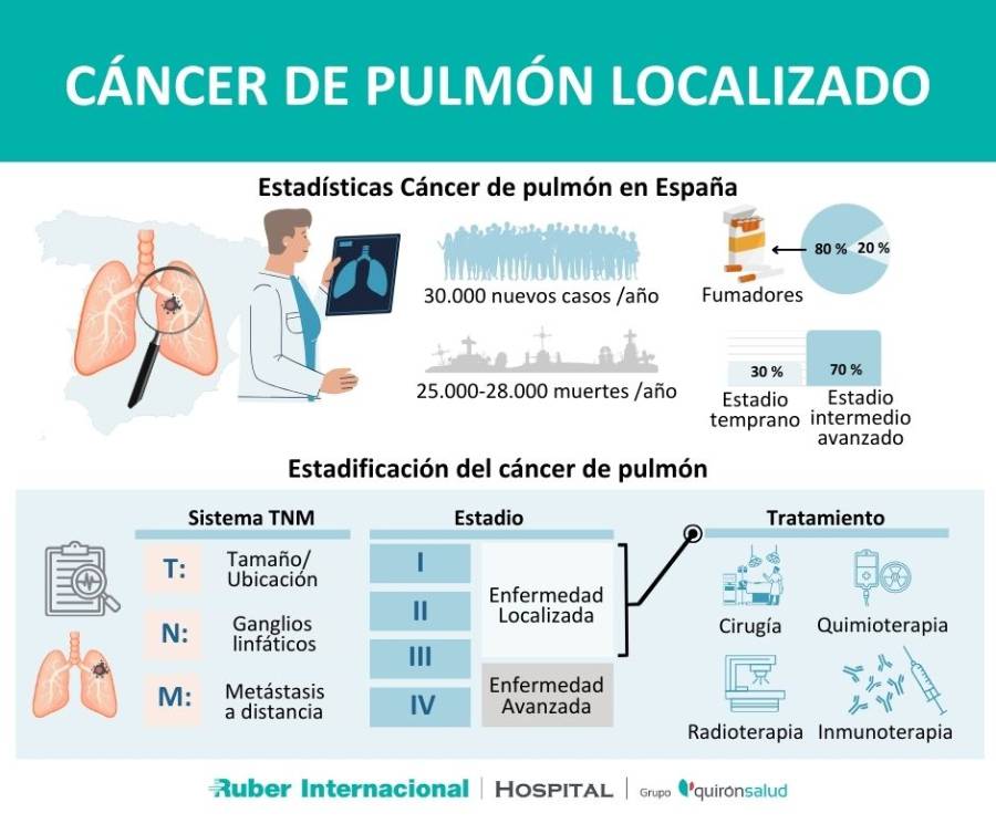 Tratamiento neoadyuvante inmunoterapia cancer de pulmon