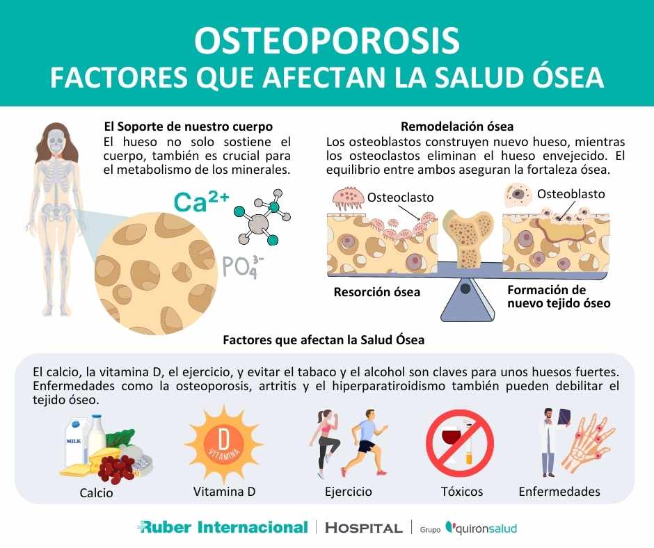 osteoporosis huesos esqueleto