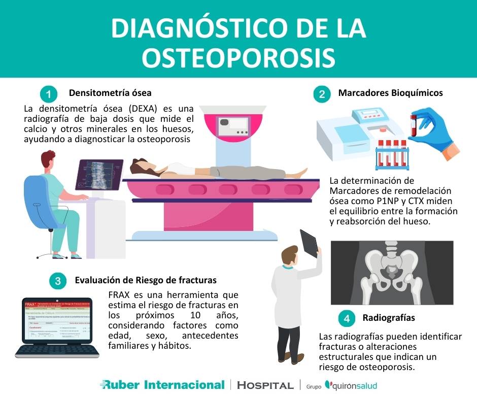 diagnostico osteoporosis