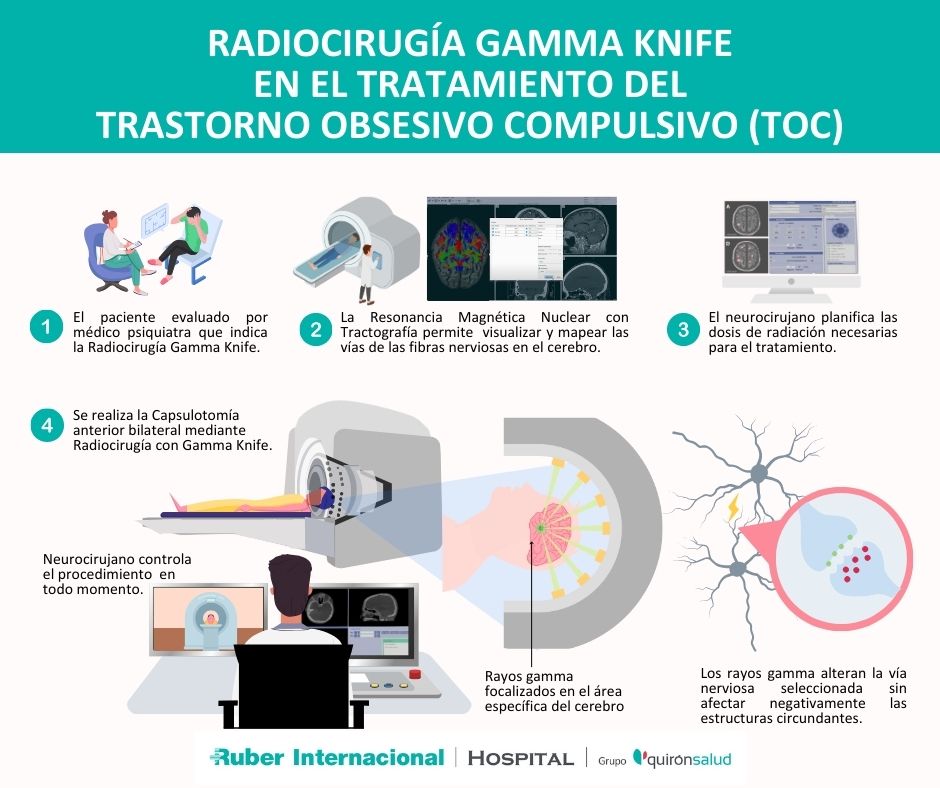 Radiocirugía gamma knife trastorno obsesivo compulsivo