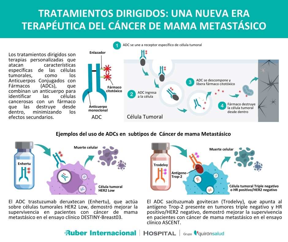 tratamiento del cancer de mama metastasico con ADC anticuerpos combinado con farmaco cancer mama metastasico (1)