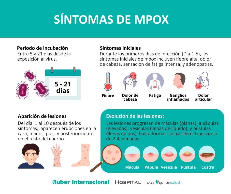 Sintomas de Mpox viruela del mono