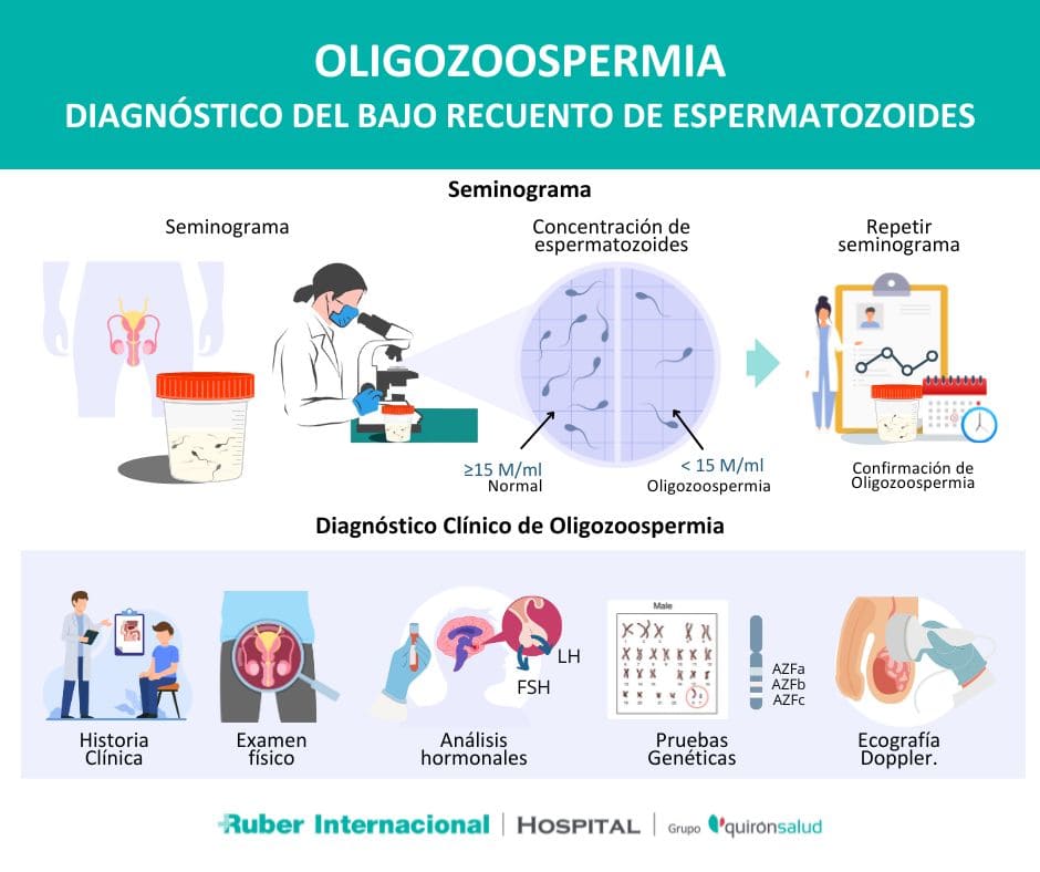 diagnostico oligozoospermia bajo conteo espermatozoides