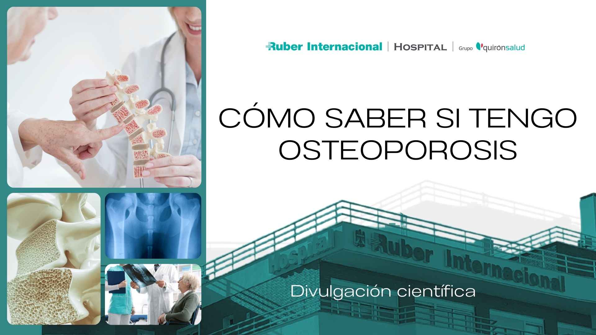 Como saber si tengo osteoporosis. Este enlace se abrirá en una ventana nueva