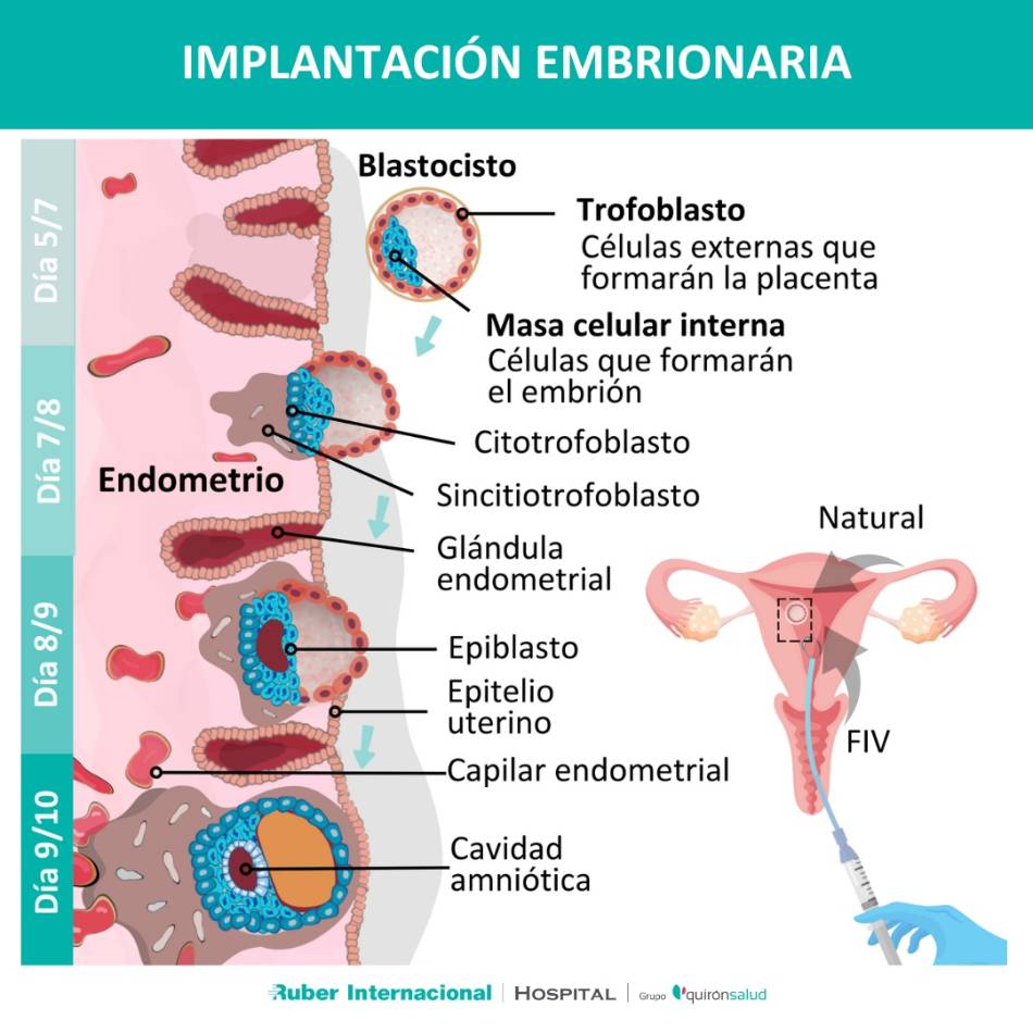 Compatibilidad KIR-HLAC embarazo implnatación