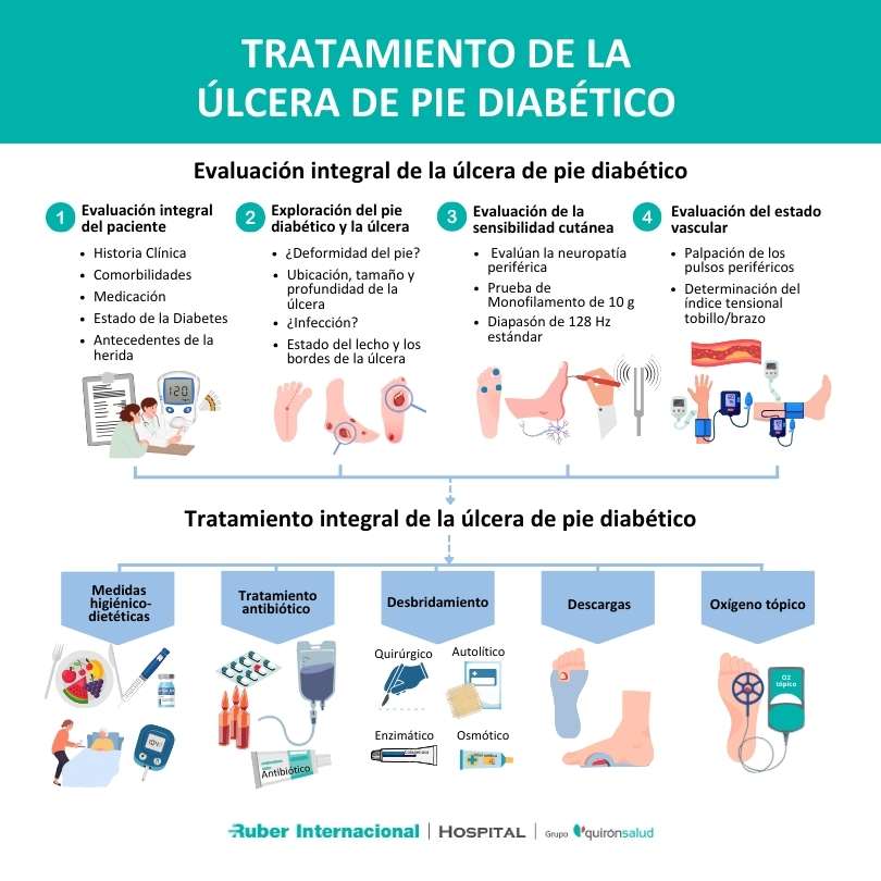 Tratamiento de la ulcera de pie diabético