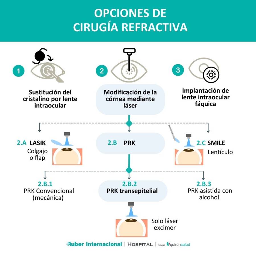 Cirugía PRK transepitelial