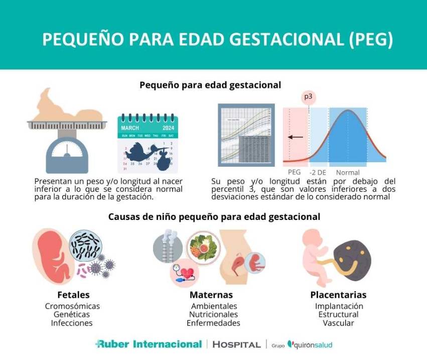 qué es Pequeño edad gestacional