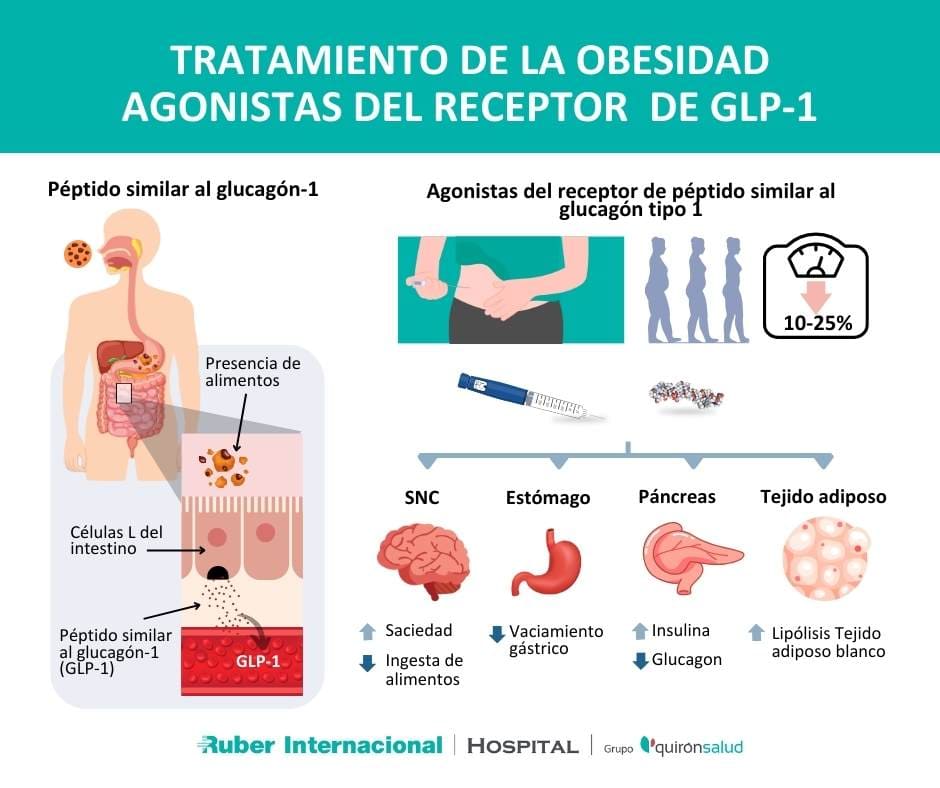 tratamiento obesidad agonista GLP1 ozempic semaglutida tirzepatida