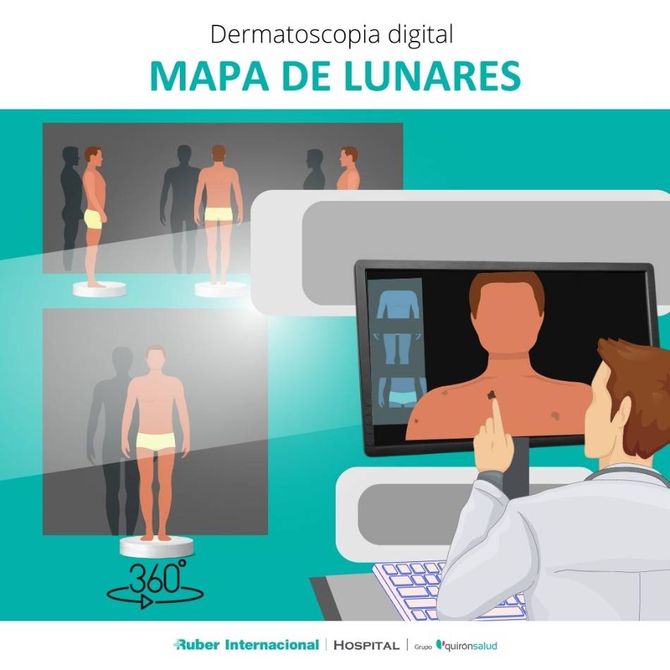 Prevención del melanoma Skin Check