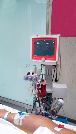 consola ECMO