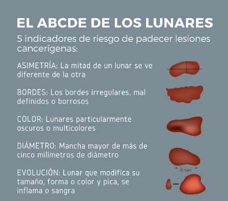 Regla ABCDE Lunares Ruber Internacional