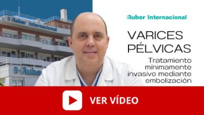 Tratamiento de embolización de las varices pélvicas. Este enlace se abrirá en una ventana nueva