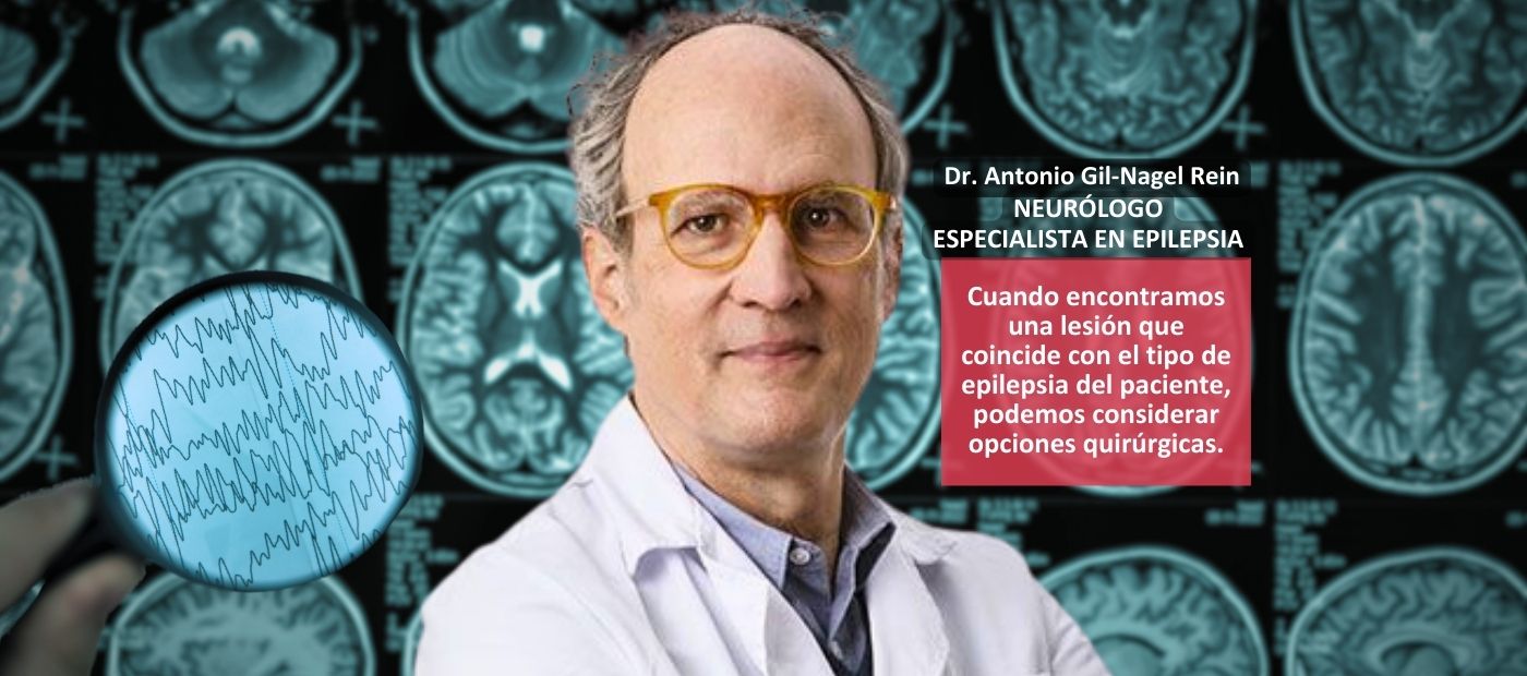 Epilepsia refractaria tratamiento diagnostico