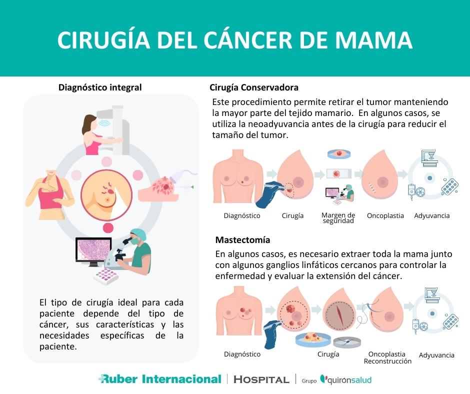 cirugia cancer de mama tratamiento