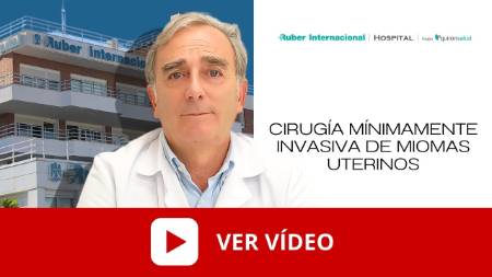 Cirugía de miomas uterinos miomectomia. Este enlace se abrirá en una ventana nueva