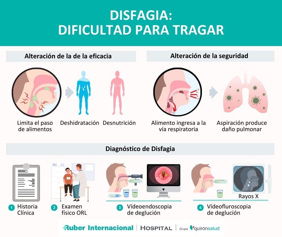 Que es disfagia Diagnostico